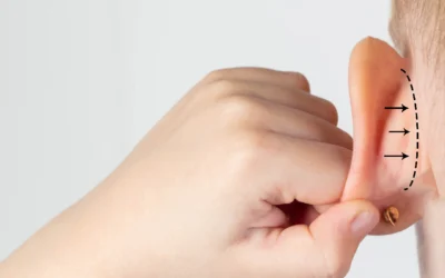 Otoplasty: Understanding the Different Types of Ear Surgery