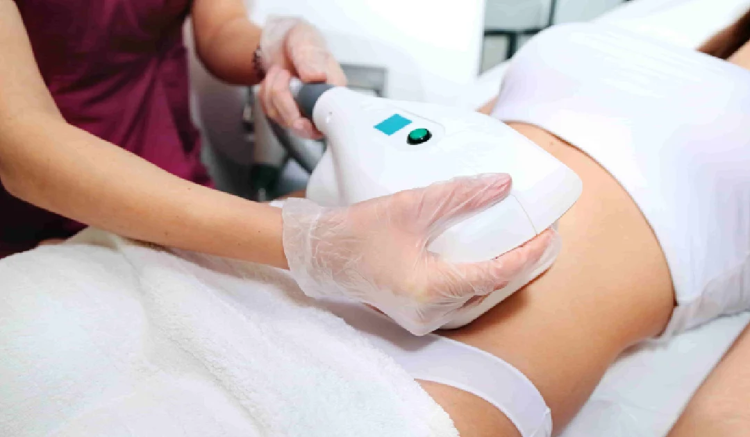 A person is receiving a CoolSculpting treatment in Biloxi, MS, with a professional moving a white device across their abdomen.