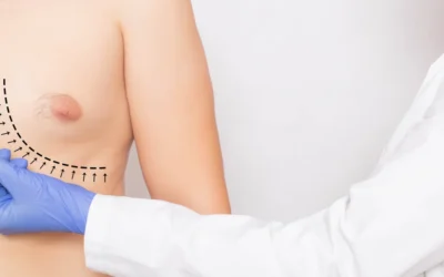 Signs and Symptoms of Gynecomastia You Should Know