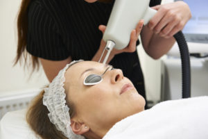 Skin Resurfacing Erbium Laser in Biloxi, MS