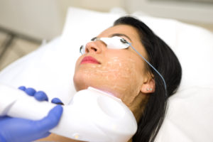 Laser Hair Removal in Biloxi, MS