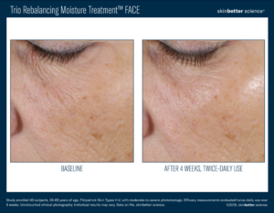 Skinbetter science® Before and After Pictures Biloxi, MS