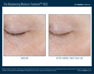 Skinbetter science® Before and After Pictures Biloxi, MS