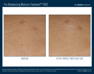 Skinbetter science® Before and After Pictures Biloxi, MS