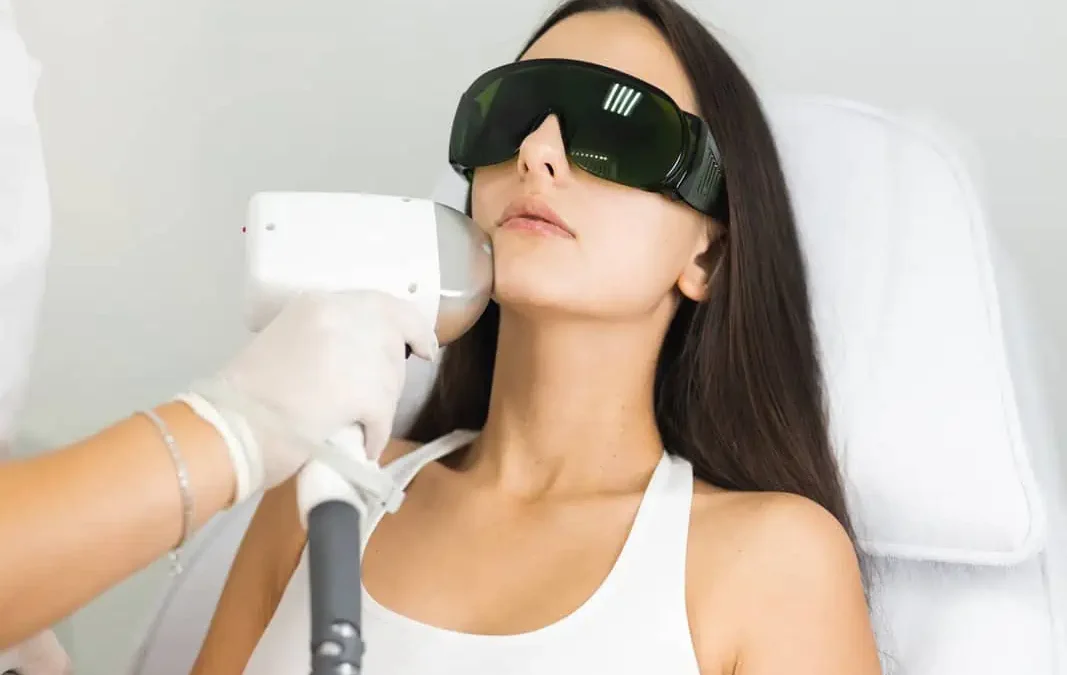 How Many Times Should I Do Laser Hair Removal?